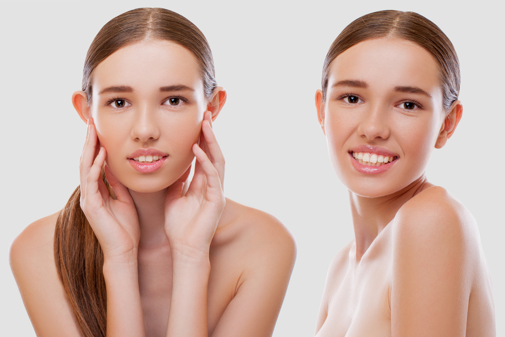 Happy,Young,Woman,Face,With,Beauty,Treatment.,Excellent,Result.,Isolated 1763749517 6ee07b9f8e5841c9b2fc9d4c6c8fafe4 1